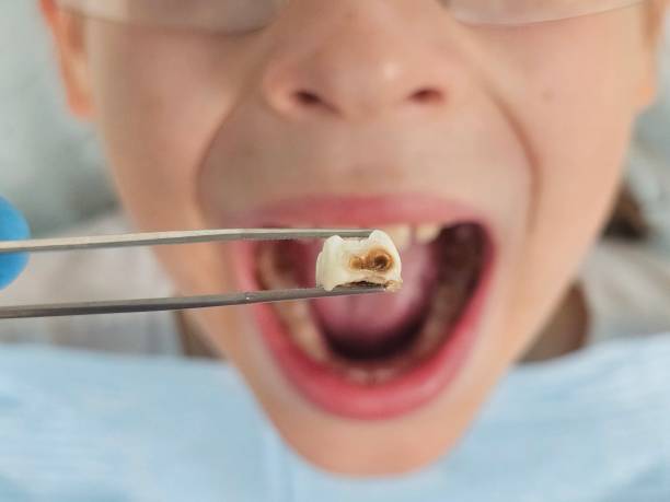 Best Emergency Dentist for Special Needs Patients in Onalaska, TX